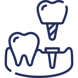 Advanced Implant Surgery